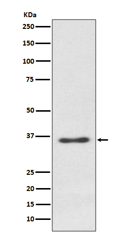 1 - Anti-Syndecan 1 SDC1 Rabbit Monoclonal Antibody ABO14053