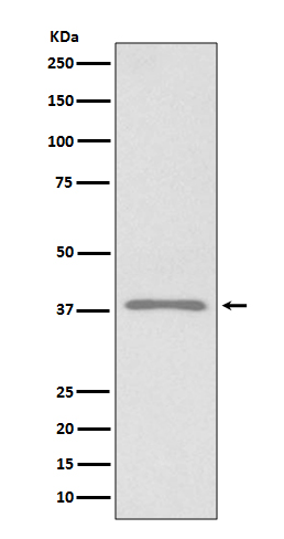 1 - Anti-Podoplanin PDPN Rabbit Monoclonal Antibody ABO14054