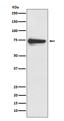 1 - Anti-Tyrosinase Rabbit Monoclonal Antibody ABO14055