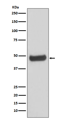 1 - Anti-PKA 2 beta PRKAR2B Rabbit Monoclonal Antibody ABO14056