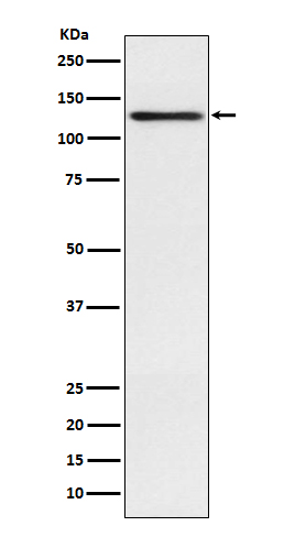 1 - Anti-Involucrin IVL Rabbit Monoclonal Antibody ABO14058