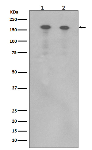 1 - Anti-ErbB (HER4) ERBB4 Rabbit Monoclonal Antibody ABO14060