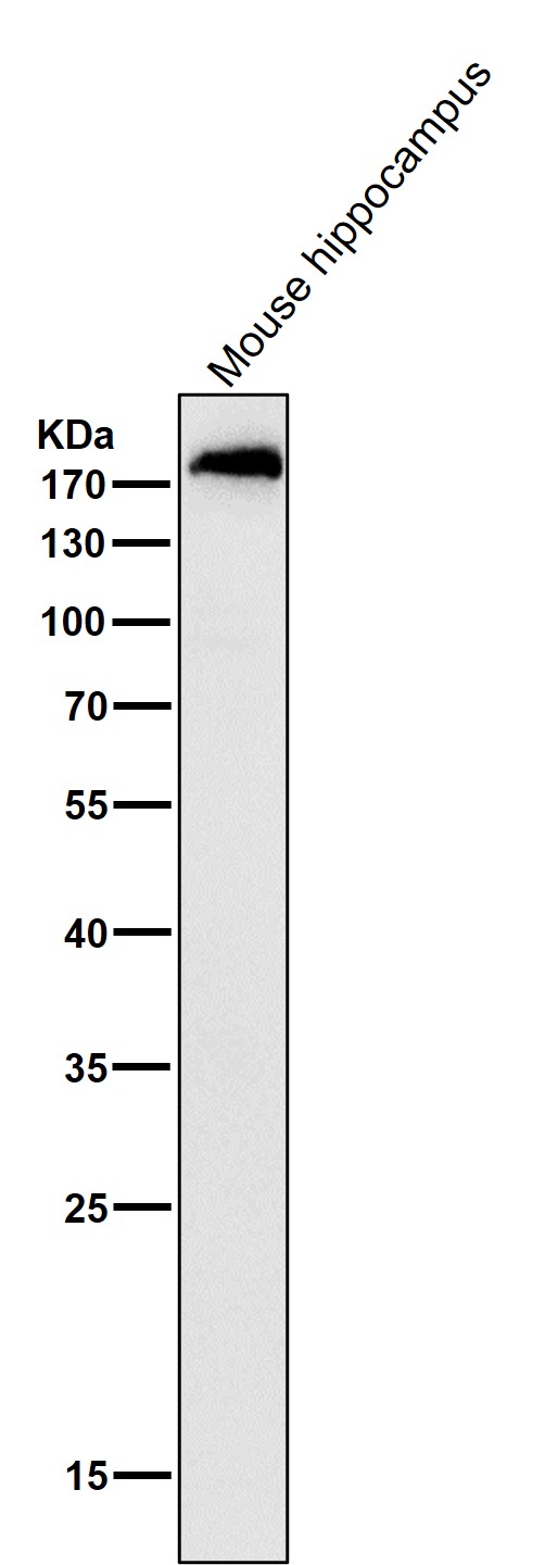 1 - Anti-ErbB (HER4) ERBB4 Rabbit Monoclonal Antibody ABO14060