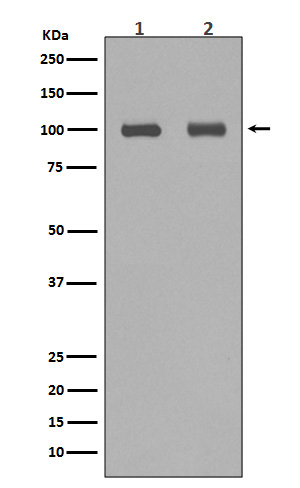 1 - Anti-Aconitase 1 ACO1 Rabbit Monoclonal Antibody ABO14061