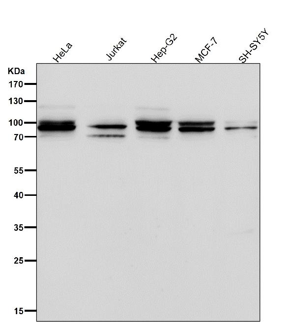 1 - Anti-Aconitase 1 ACO1 Rabbit Monoclonal Antibody ABO14061