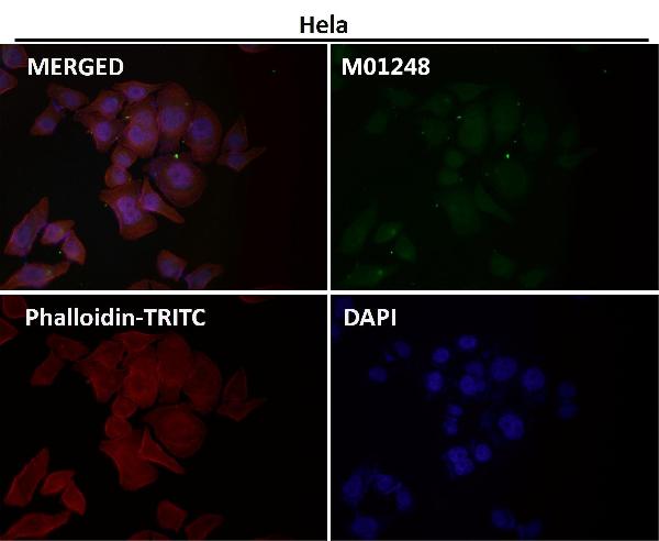 1 - Anti-HIF-2 alpha EPAS1 Rabbit Monoclonal Antibody ABO14062