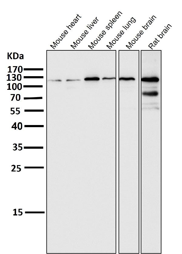 1 - Anti-HIF-2 alpha EPAS1 Rabbit Monoclonal Antibody ABO14062