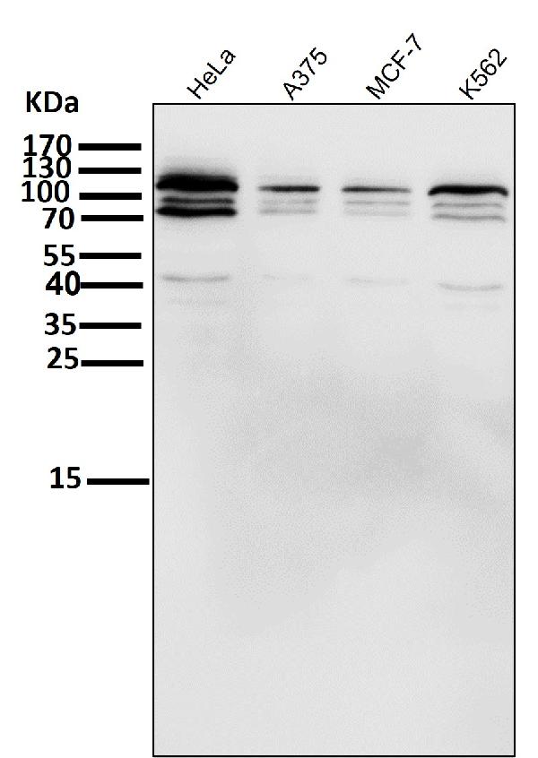 1 - Anti-HIF-2 alpha EPAS1 Rabbit Monoclonal Antibody ABO14062