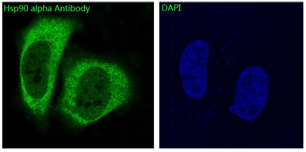 3 - Anti-Hsp90 alpha HSP90AA1 Rabbit Monoclonal Antibody ABO14063