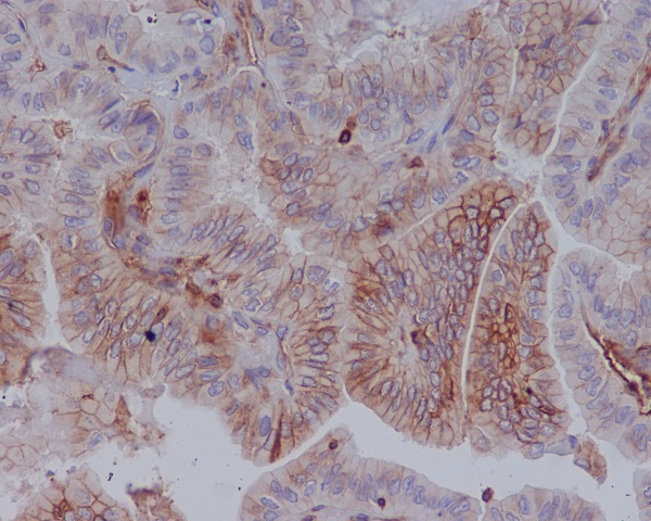 2 - Anti-MHC class 1 HLA-A Rabbit Monoclonal Antibody ABO14065