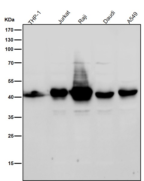 1 - Anti-MHC class 1 HLA-A Rabbit Monoclonal Antibody ABO14065