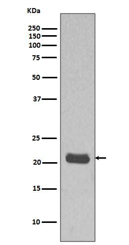 1 - Anti-GTPase HRAS Rabbit Monoclonal Antibody ABO14066