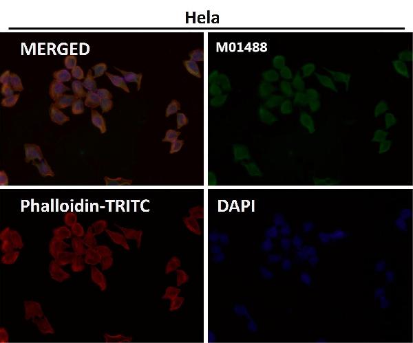 1 - Anti-Met (c-Met) Rabbit Monoclonal Antibody ABO14067