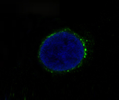3 - Anti-Met (c-Met) Rabbit Monoclonal Antibody ABO14067