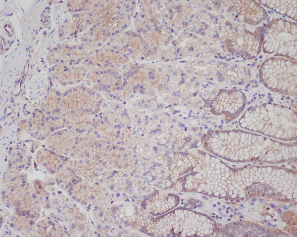 2 - Anti-Met (c-Met) Rabbit Monoclonal Antibody ABO14067