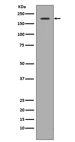 1 - Anti-Met (c-Met) Rabbit Monoclonal Antibody ABO14067