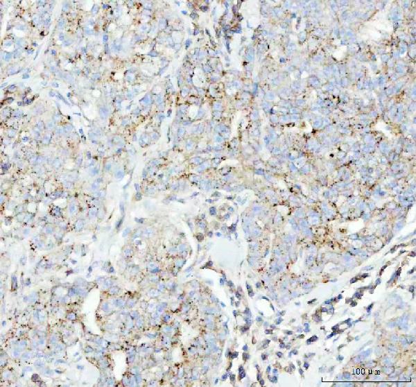 2 - Anti-Flotillin 1 FLOT1 Rabbit Monoclonal Antibody ABO14068
