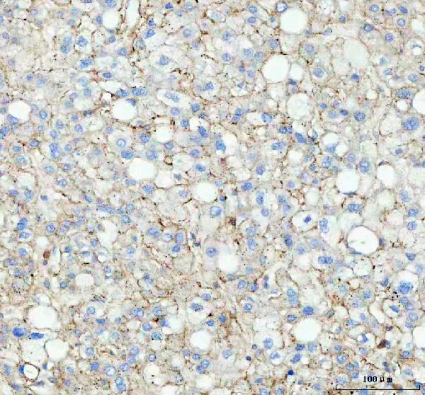2 - Anti-Flotillin 1 FLOT1 Rabbit Monoclonal Antibody ABO14068