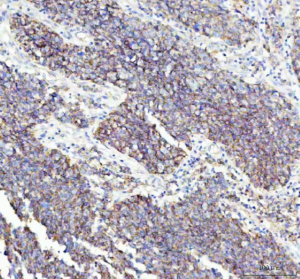2 - Anti-Flotillin 1 FLOT1 Rabbit Monoclonal Antibody ABO14068