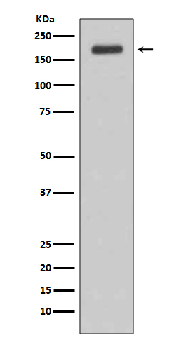 1 - Anti-ErbB (HER3) Rabbit Monoclonal Antibody ABO14070