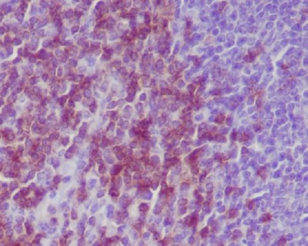 2 - Anti-CD3 epsilon Rabbit Monoclonal Antibody ABO14071