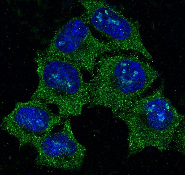 3 - Anti-Hsp90 alpha HSP90AA1 Rabbit Monoclonal Antibody ABO14072