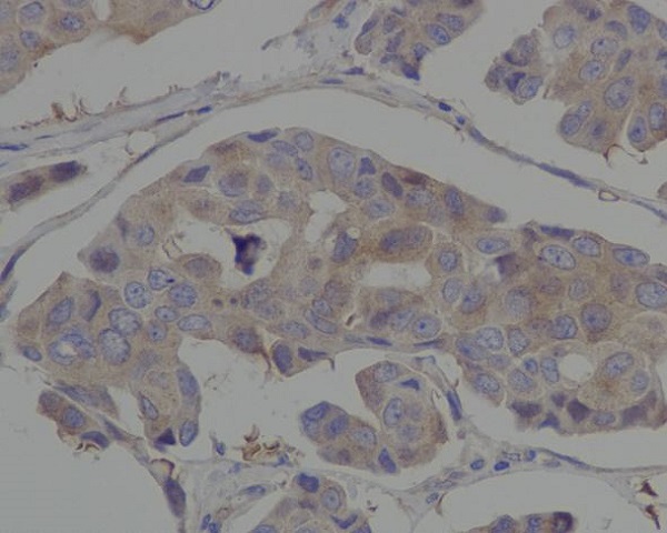 2 - Anti-Hsp90 alpha HSP90AA1 Rabbit Monoclonal Antibody ABO14072