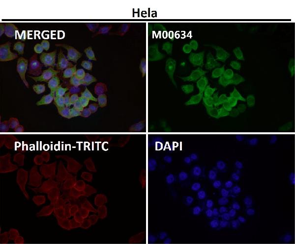 1 - Anti-Osteopontin SPP1 Rabbit Monoclonal Antibody ABO14073