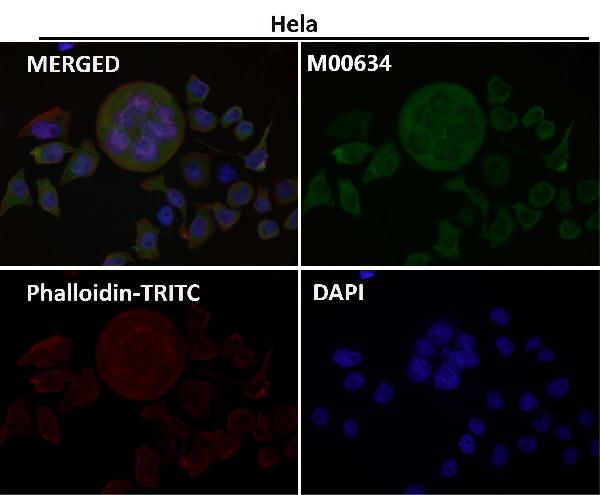 1 - Anti-Osteopontin SPP1 Rabbit Monoclonal Antibody ABO14073