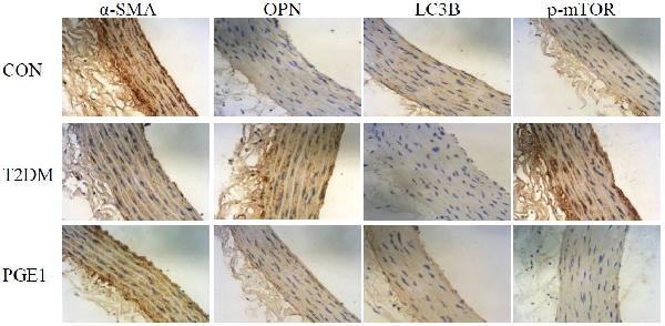 2 - Anti-Osteopontin SPP1 Rabbit Monoclonal Antibody ABO14073