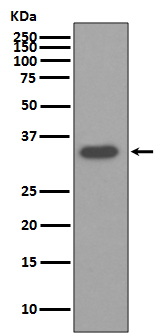 1 - Anti-Osteopontin SPP1 Rabbit Monoclonal Antibody ABO14073