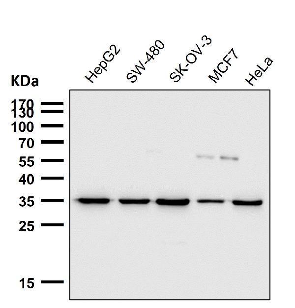 1 - Anti-Osteopontin SPP1 Rabbit Monoclonal Antibody ABO14073