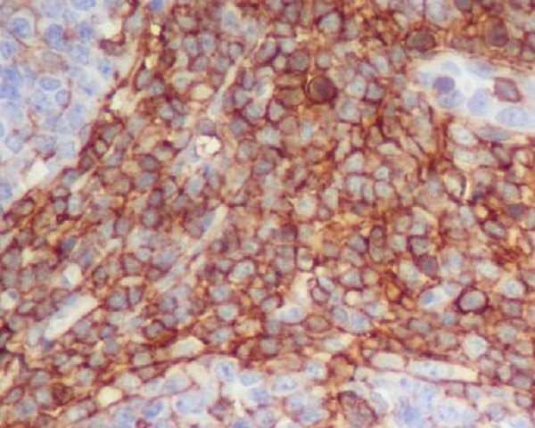 2 - Anti-CD90 / Thy1 Rabbit Monoclonal Antibody ABO14074