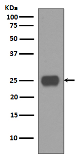 1 - Anti-CD90 / Thy1 Rabbit Monoclonal Antibody ABO14074