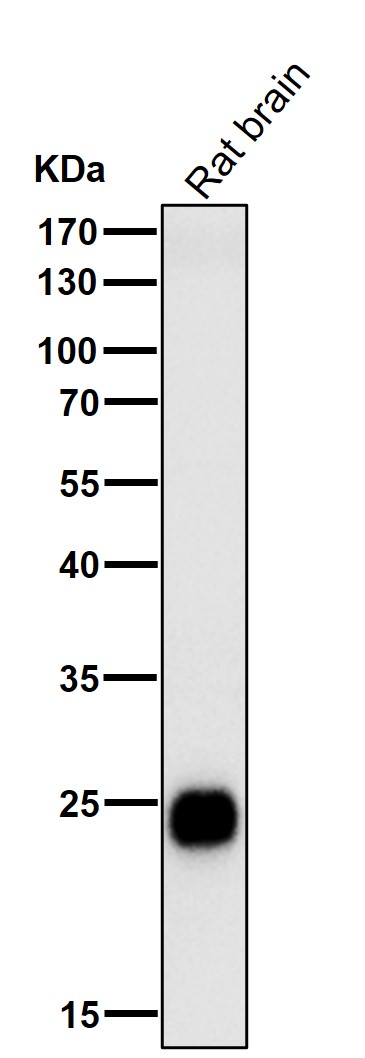 1 - Anti-CD90 / Thy1 Rabbit Monoclonal Antibody ABO14074