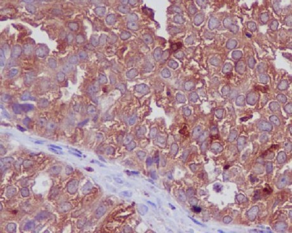 2 - Anti-Cathepsin D CTSD Rabbit Monoclonal Antibody ABO14075