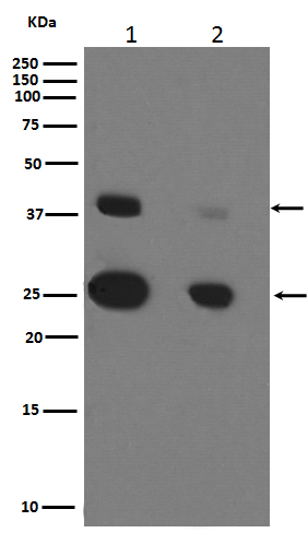 1 - Anti-Cathepsin D CTSD Rabbit Monoclonal Antibody ABO14075