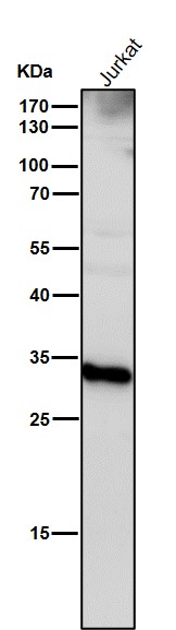 1 - Anti-Cathepsin D CTSD Rabbit Monoclonal Antibody ABO14075