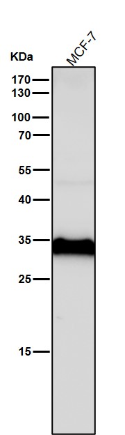 1 - Anti-Cathepsin D CTSD Rabbit Monoclonal Antibody ABO14075