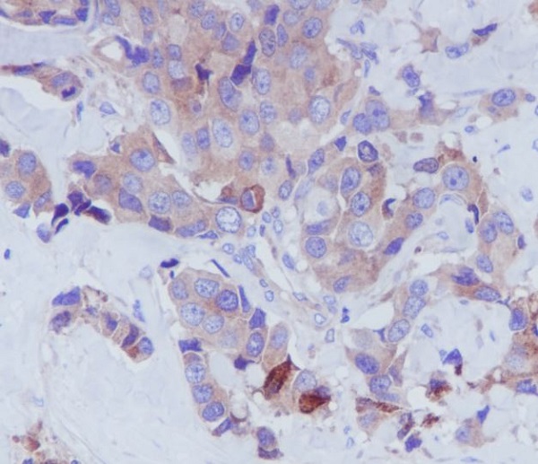 2 - Anti-Transferrin TF Rabbit Monoclonal Antibody ABO14076