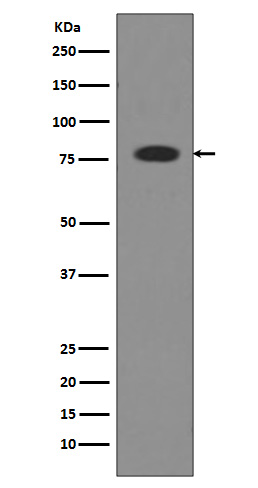 1 - Anti-Transferrin TF Rabbit Monoclonal Antibody ABO14076