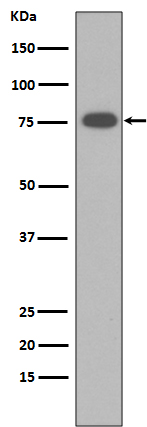 1 - Anti-Vitronectin VTN Rabbit Monoclonal Antibody ABO14077