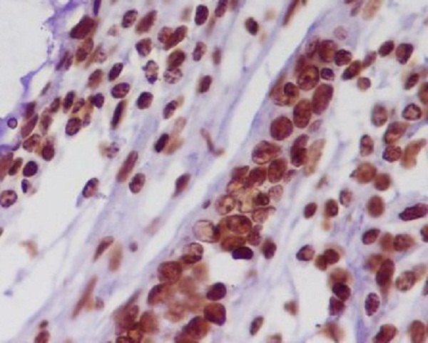 2 - Anti-Histone H2A HIST1H2AB Rabbit Monoclonal Antibody ABO14078
