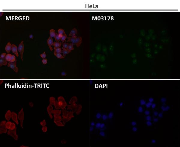 1 - Anti-Fibrillarin FBL Rabbit Monoclonal Antibody ABO14079