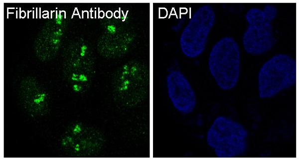 3 - Anti-Fibrillarin FBL Rabbit Monoclonal Antibody ABO14079
