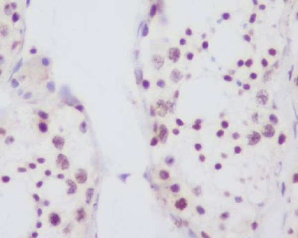 2 - Anti-Fibrillarin FBL Rabbit Monoclonal Antibody ABO14079