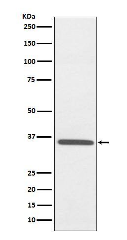 1 - Anti-Fibrillarin FBL Rabbit Monoclonal Antibody ABO14079