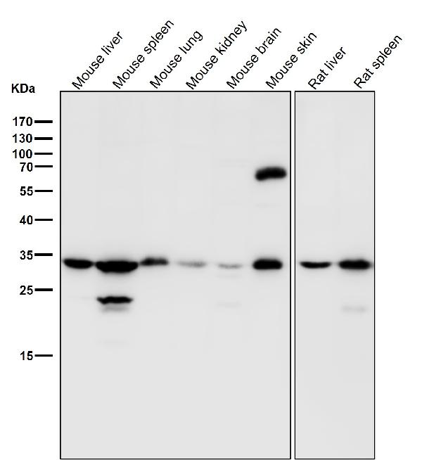 1 - Anti-Fibrillarin FBL Rabbit Monoclonal Antibody ABO14079