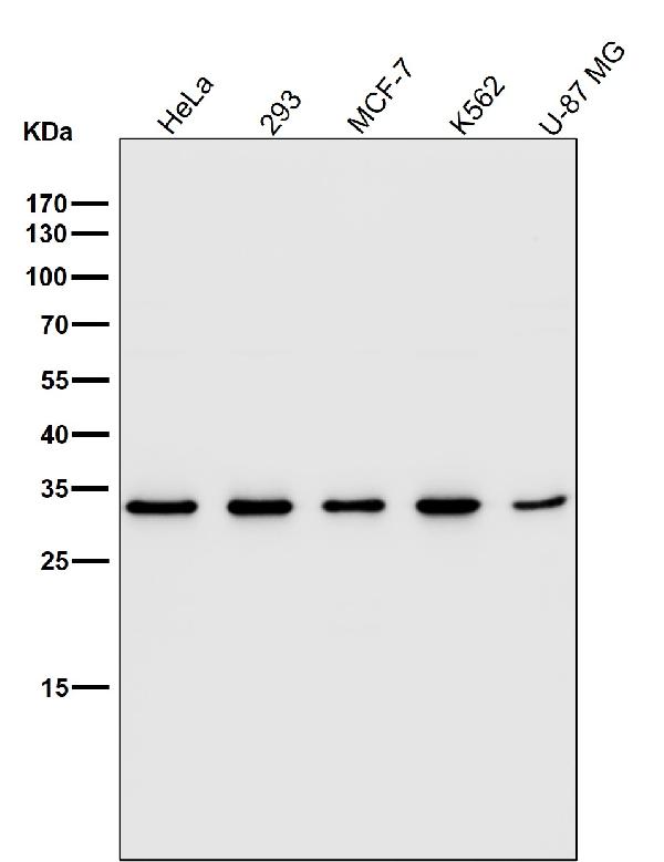 1 - Anti-Fibrillarin FBL Rabbit Monoclonal Antibody ABO14079