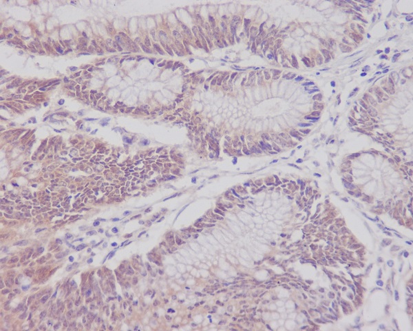 2 - Anti-CD3 epsilon Rabbit Monoclonal Antibody ABO14080